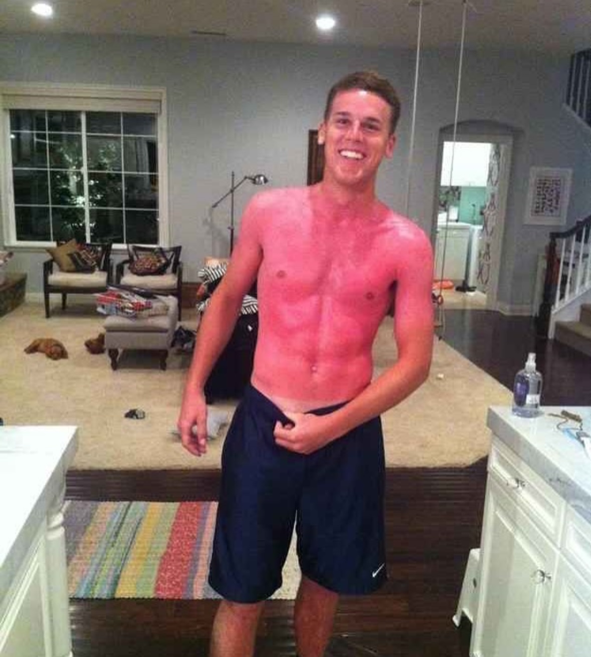 The Lobster | The Accidental Art of Sunburn: A Humorous Look at Photoprotection Failures and the Serious Science Behind Them)