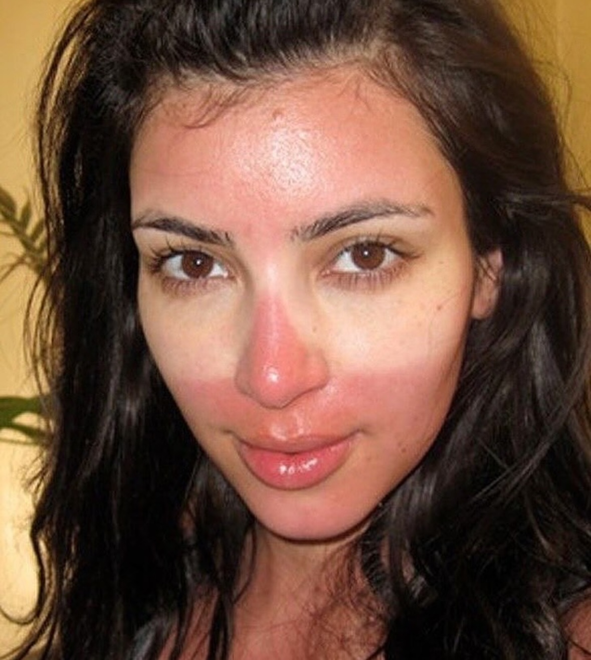 The Sunglass Tan | The Accidental Art of Sunburn: A Humorous Look at Photoprotection Failures and the Serious Science Behind Them)