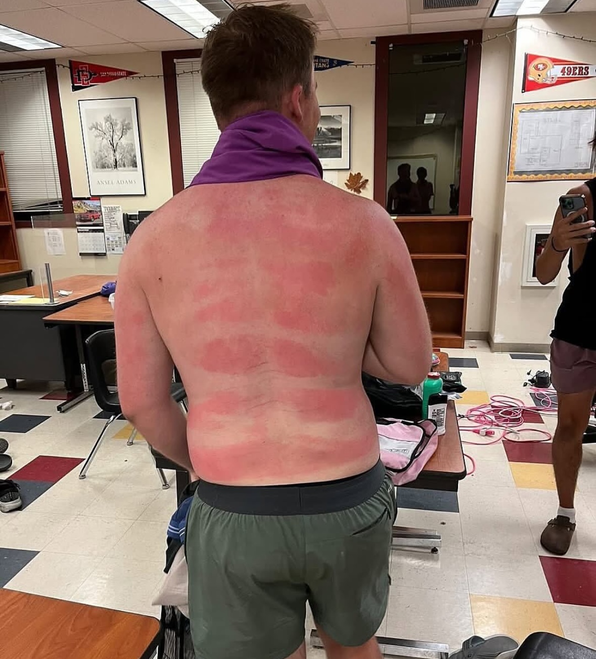 The Strappy Swimsuit Grid | The Accidental Art of Sunburn: A Humorous Look at Photoprotection Failures and the Serious Science Behind Them)