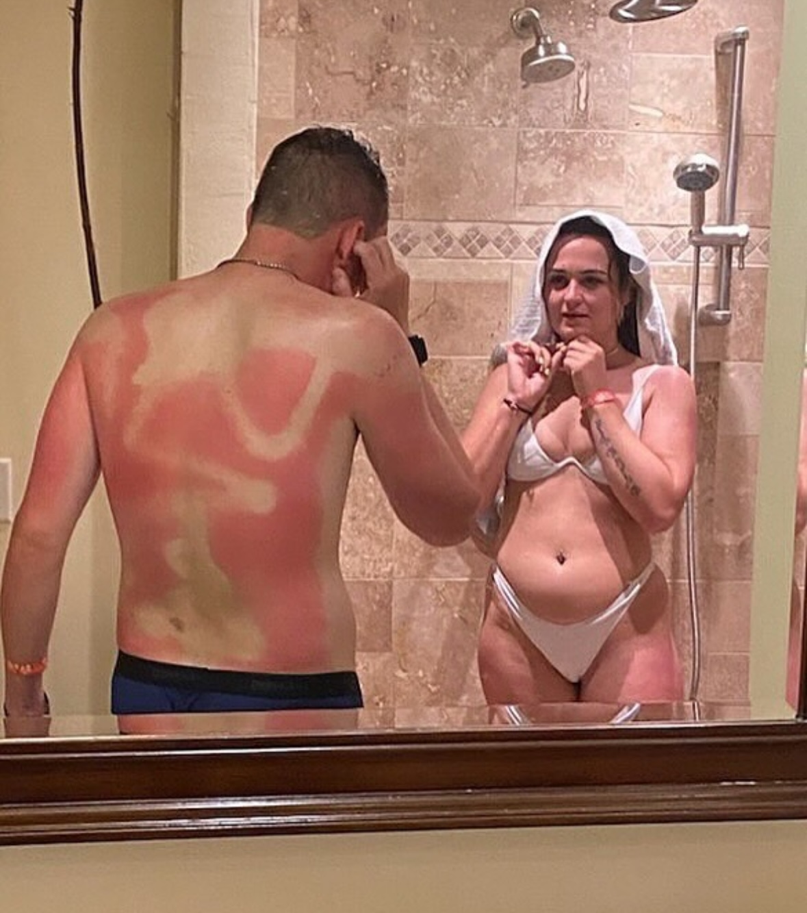 The Abstract Expressionist (a.k.a. Streaky Roll-On Application) | The Accidental Art of Sunburn: A Humorous Look at Photoprotection Failures and the Serious Science Behind Them)